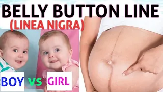 Belly button line| linea nigra|gender Prediction in Pregnancy