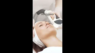 IPL-терапія в Denysenko Clinic