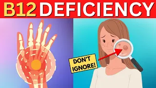 Don't Ignore These Warning Signs of Vitamin B12 Deficiency!