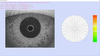 2. Tear break-up time(NIBUT) test  by Kanghua Dry Eye Analyzer Operation Guide