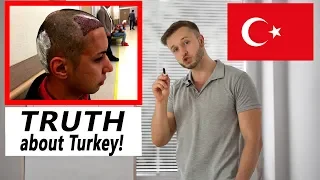 FUE Hair Transplant in Turkey? The TRUTH...