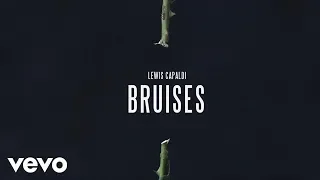 Lewis Capaldi Bruises (Cover) ft. xBinks