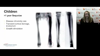 Pediatric Osteomyelitis, Septic Arthritis, and MSK Infections- Oh My! -Sarah Stelma, MD