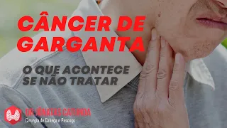 Câncer de garganta sem tratamento, qual a sobrevida?