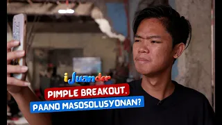 3-day peel, effective nga kayang pampakinis?! | I Juander