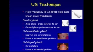 Ultrasound of the Salivary Glands