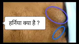 What is Inguinal Hernia - निदान कैसे करें - How to Diagnose