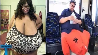 Top 10 People With Unusual Biggest Body Parts In The World #1