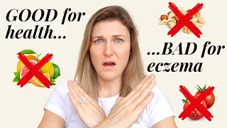 7 foods GOOD for your health, BAD for your ECZEMA (AVOID THESE!) | Foods to Avoid for Eczema