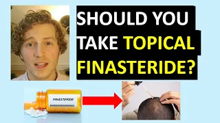 Topical Finasteride For Hair Loss?