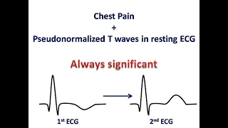 ECG course: Pseudonormalization of T waves, Dr. Sherif Altoukhy