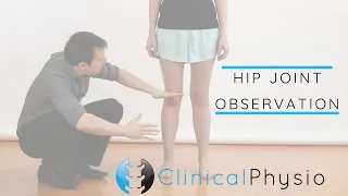 Hip Joint Observation | Clinical Physio