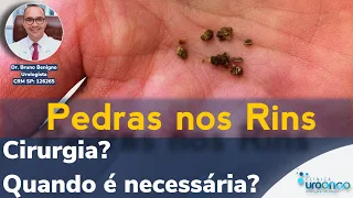 Pedra nos Rins | Quando a Cirurgia é Necessária?