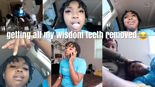 I Got All 4 Of My Wisdom Teeth Removed ***HILARIOUS***