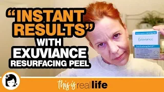 "Instant Results" with Exuviance Resurfacing Peel - THIS IS REAL LIFE