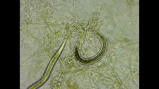 Predation of plant parasitic nematodes by other soil organisms