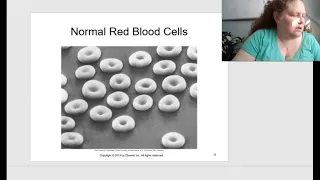 Baker Pathophysiology Chapter 10 Blood and Circulatory Disor