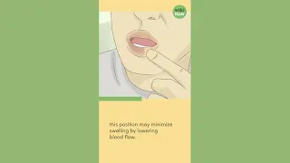 How To Reduce Lip Swelling