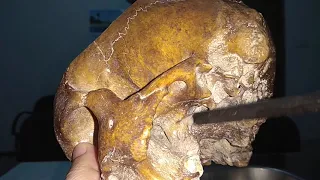 Maxillary Nerve : Tracing Its Course in a Real Human Skull