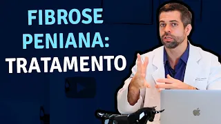 Tratamento para a Fibrose Peniana | Dr. Marco Túlio Cavalcanti - Urologista e Andrologista