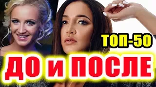 ДОМ 2 ДО И ПОСЛЕ ПЛАСТИКИ (НОВИНКА)