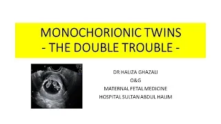 MONOCHORIONIC TWIN