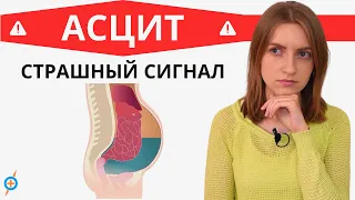 Какие болезни ведут к АСЦИТУ (водянке живота)? | Mednavigator.ru