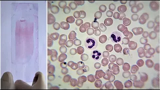 Blood Smear Preparation and Staining Practical Lab