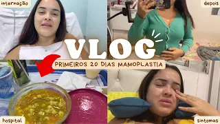 DIÁRIO DA MAMOPLASTIA REDUTORA - vlog dia da cirurgia, PÓS OPERATÓRIO, recuperação e sintomas  #2