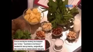 Камни в почках и мочеточниках - причины образования, симптомы и лечение