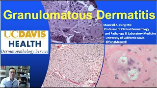 DERMATOPATHOLOGY: Granulomatous Dermatitis