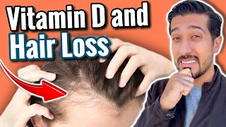 Vitamin D Deficiency HAIR LOSS | Is Vitamin D Hair Loss Reversible?