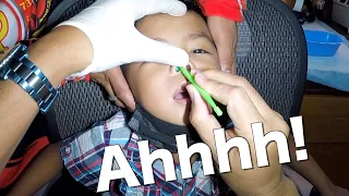 Something Stuck in Boy's Nose Removed | What is it?