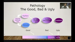 NBE- MANAGEMENT OF THYROID MALIGNANCIES- DR. ADITYA JOSHIPURA