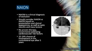 Optic Neuropathies