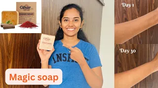 @gharsoaps Magic Soap review |Ghar soaps honest review | get rid of black spots, scars #magicsoap