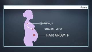 VERIFY: Baby or Bust - Myths about pregnancy and hair