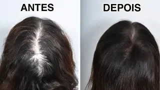 COMO ACABEI MINHA QUEDA DE CABELO SEM GASTAR NADA