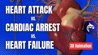 The Difference between Cardiac Arrest, Heart Attack, and Heart Failure - 3D Animation