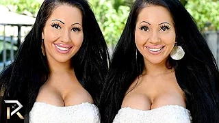 10 Unusual Twins You Won’t Believe Exist