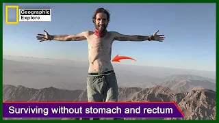 The life story of a brave man who survived without stomach and rectum | English life story