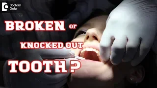 What to do for a broken tooth or knocked out tooth? - Dr. Aniruddha KB