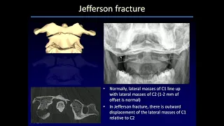 Imaging Skeletal trauma