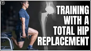 How I Train With a Total Hip Replacement as a 31 Year Old