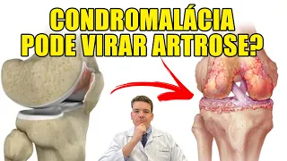 CONDROMALÁCIA PODE VIRAR ARTROSE?