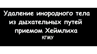 Прием Хеймлиха (Геймлиха, Хаймлиха) - удаление инородного тела из дыхательных путей - meduniver.com