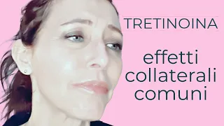 TRETINOINA *acido retinoico EFFETTI COLLATERALI COMUNI