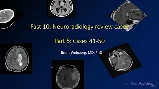 Fast 10: Neuroradiology high speed case review part 5 - Cases 41-50