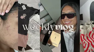 weekly vlog | fighting acne, getting a chemical peel, kids clothing haul, PR, target trips + more!