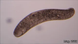 Spirostomum Under the Microscope